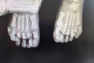 Рентгенография пресс-службы Минздрава Московской области