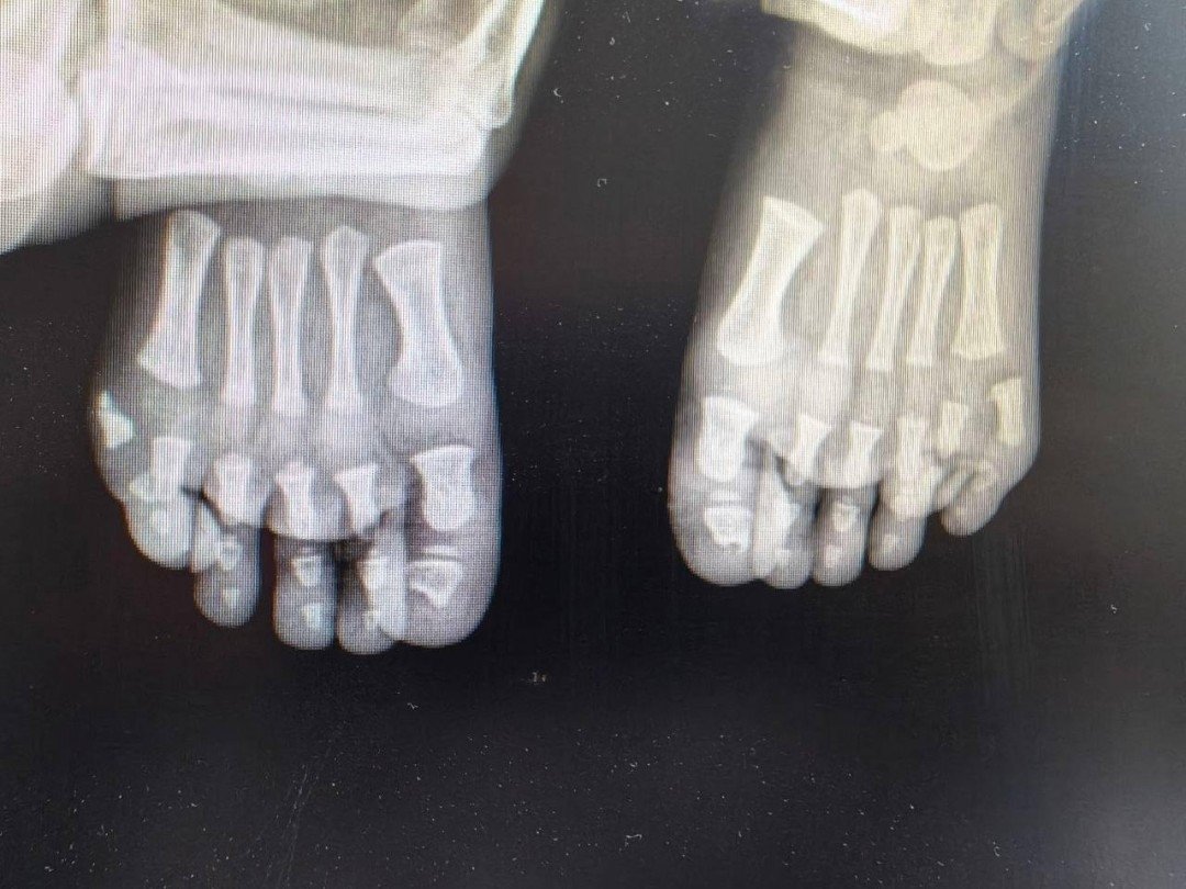 Рентгенография пресс-службы Минздрава Московской области